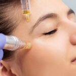 10-intrebari-despre-terapia-PRP
